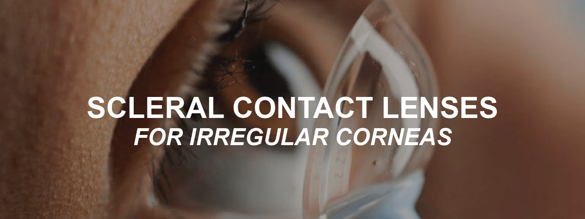 #1 Scleral Lenses in Delhi - Visual Aids Centre