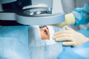 Lasik Surgery Operation