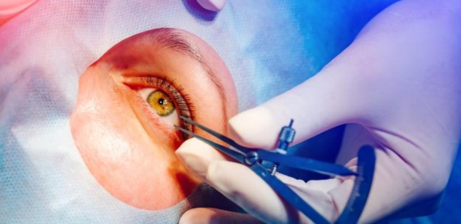 Is Lasik Surgery Safe? - Visual Aids Centre