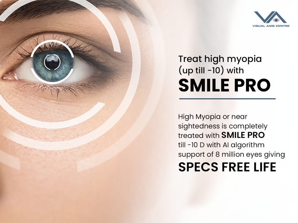 What Are the Advantages of Smile Pro Eye Surgery?
