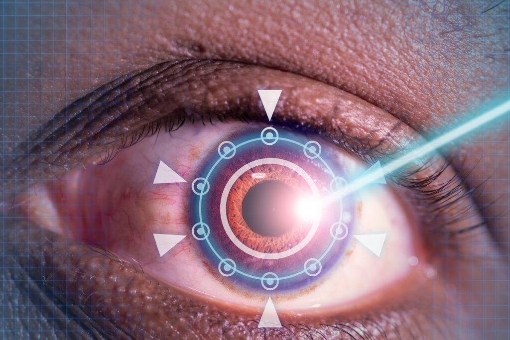 can-lasik-surgery-be-repeated