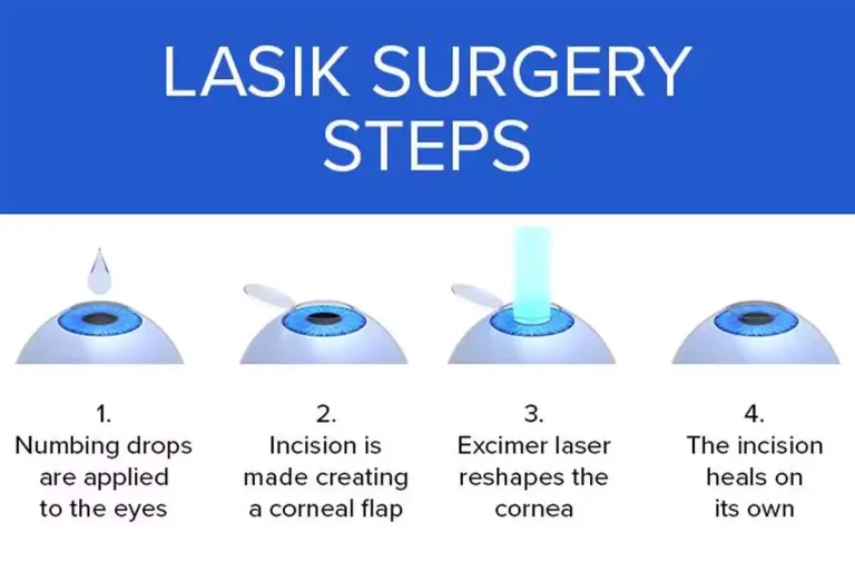 Inventor of LASIK Eye Surgery in India