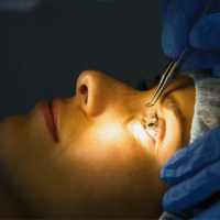 Person undergoing a laser eye surgery procedure in a clinical setting, focusing on the eye with advanced medical equipment in the background