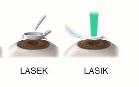 What Is The Difference Between Lasik And Lasek?