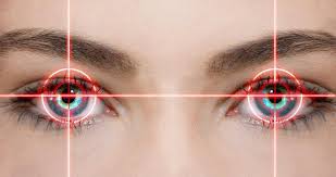 What To Do Before Lasik Eye Surgery?