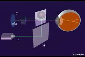 How Does Ray Tracing Technology Help Create Precise Corneal Ablation Profiles?