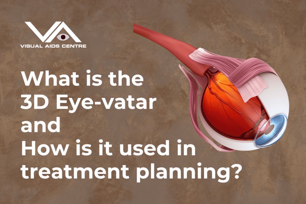 Illustration of a human eye anatomy with text: "What is the 3D Eye-vatar and How is it used in treatment planning?" and the logo of Visual Aids Centre in the upper left corner.