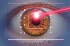 Difficulty Opening Eyes After LASIK