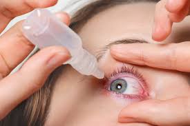 Permanent Dry Eyes After LASIK