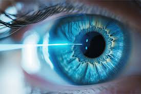 Does Lasik Mess Up Close Vision