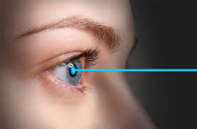 Can You Get Lasik If You Have Multiple Sclerosis?