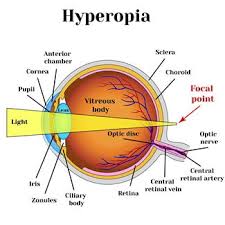 What factors influence the cost of Wavelight Plus InnovEyes?