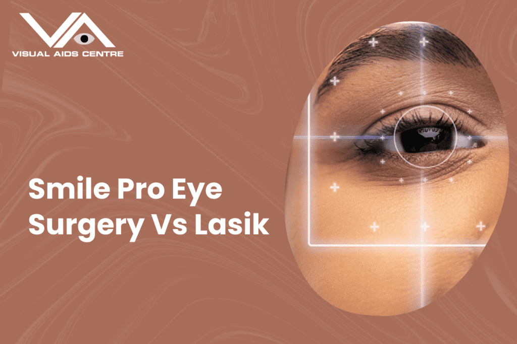 A close-up of an eye with digital markers and crosshairs superimposed, accompanied by the text "Smile Pro Eye Surgery Vs Lasik".