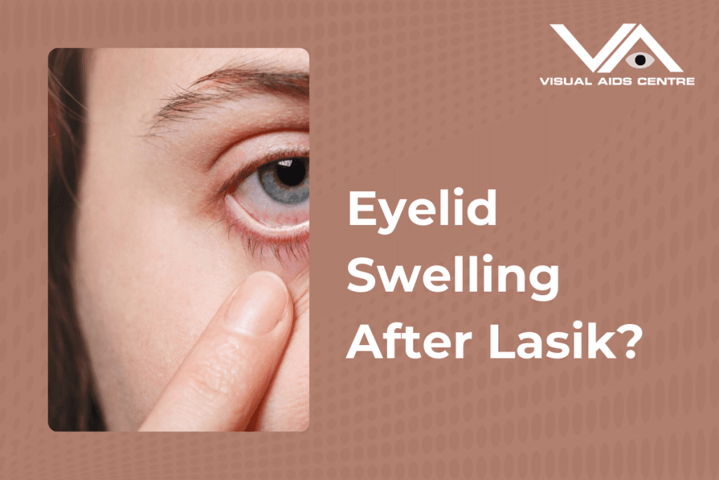 A close-up of a person's eye with noticeable redness, while a finger gently pulls down the lower eyelid, with the caption "Eyelid Swelling After Lasik?" on the right.