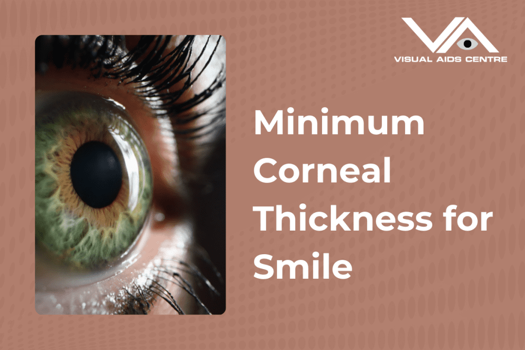 A close-up of a greenish-brown eye with prominent eyelashes, highlighting the corneal surface, accompanied by the caption "Minimum Corneal Thickness for Smile" on the right.