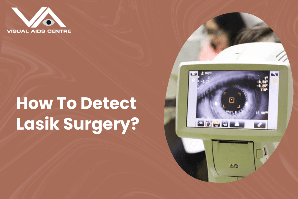 A close-up of an eye being examined on a diagnostic screen with the text "How To Detect Lasik Surgery?".