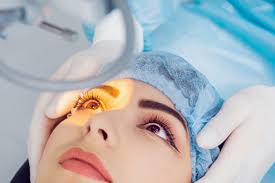 Does Tcs Health Insurance Cover Lasik?