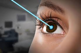 Do Doctor Touch Eye During Lasik?