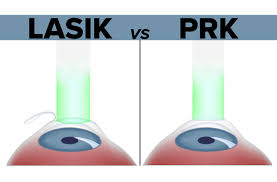 SMILE Vs LASIK Vs PRK