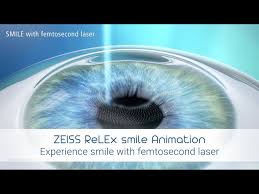 Why More Ophthalmologists Are Recommending Smile Pro Surgery?