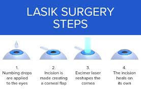 When Does Lasik Stop Working?