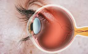 Preoperative Corneal Thickness On Lasik?