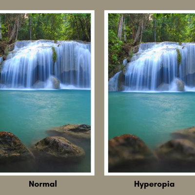 Hyperopia (Farsightedness):